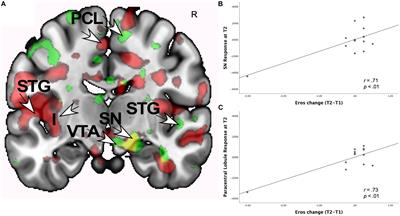 After the Honeymoon: Neural and Genetic Correlates of Romantic Love in Newlywed Marriages